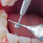 Dentist Palmdale